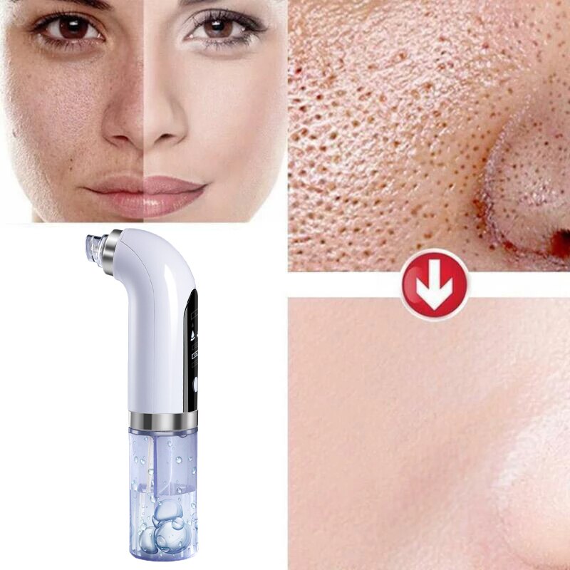 Skin Care Pro® - Limpeza profunda de pele