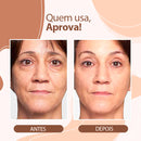 Bálsamo Derol - Eliminador de Rugas